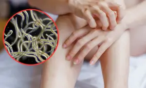 Objawy odrobaczania – czego się spodziewać po leczeniu pasożytów?